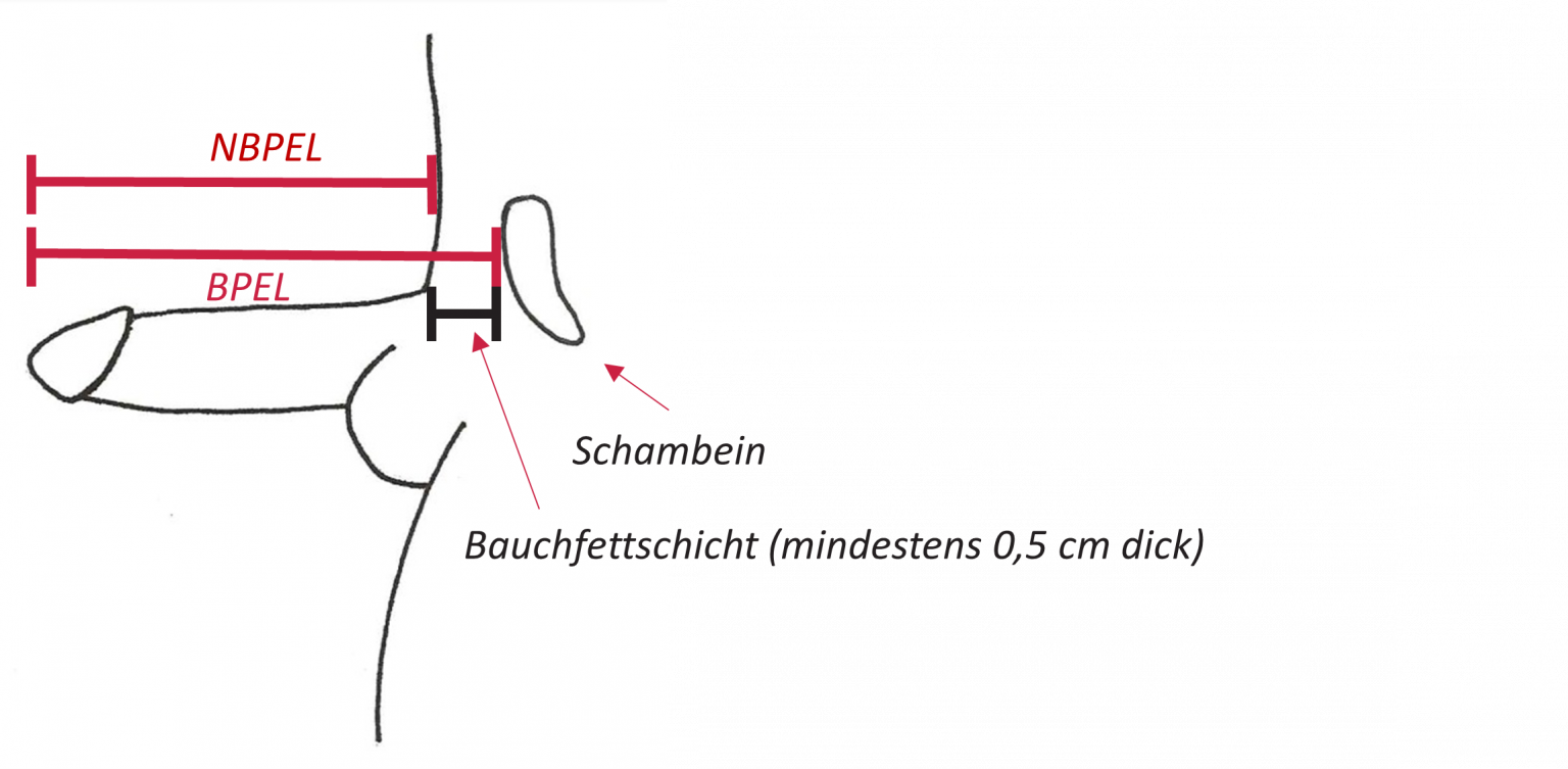 Wie Groß Sollte Ein Penis Sein